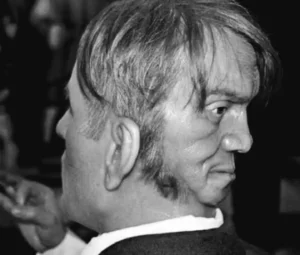 The Man with Two Faces: Edward Mordake