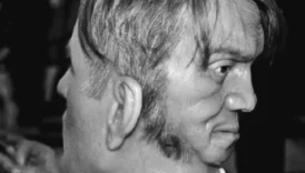 İki Yüzü Olan Adam Edward Mordake