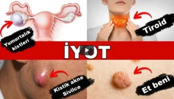 8 Surprising Benefits of Iodine - Health
